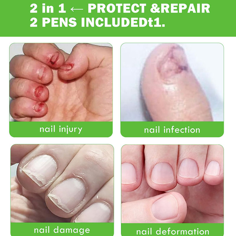 No-Bite Nail Care Solution π