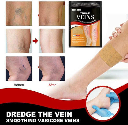 Varicose Veins Patch